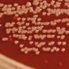 Yersinia enterocolitica bacteria growing on a Xylose Lysine Sodium Deoxycholate (XLD) agar plate.